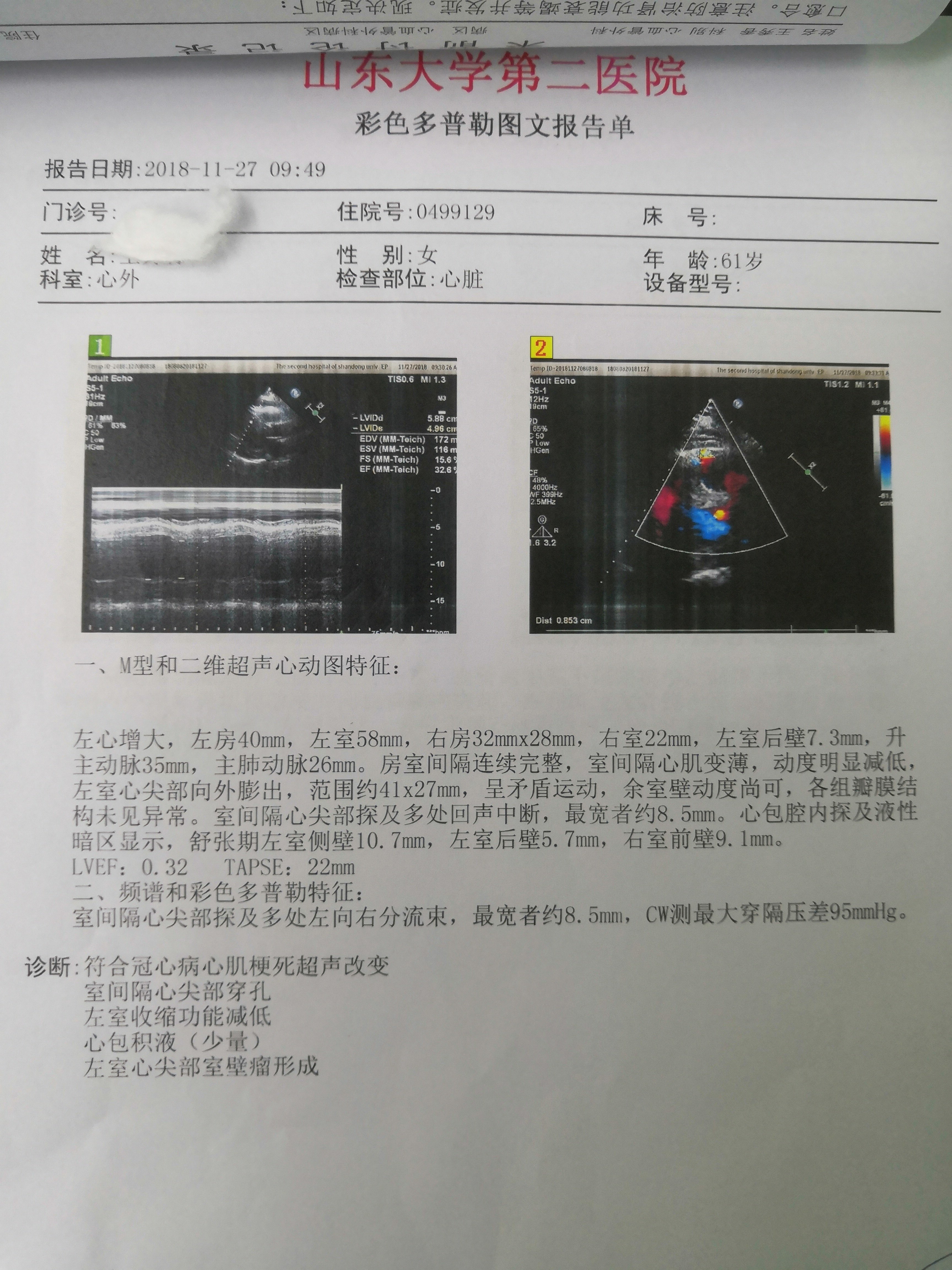 心肌梗塞的报告图片图片