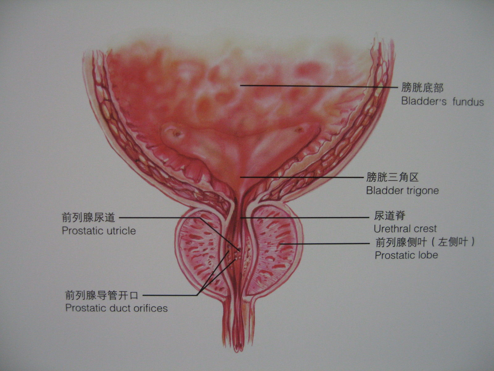 经尿道前列腺电切术