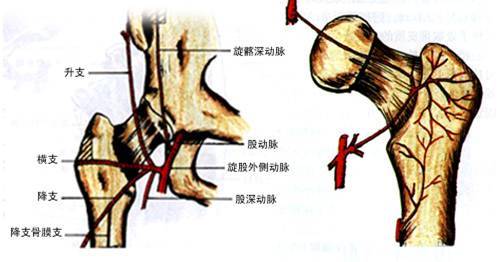 股骨頭壞死的防治