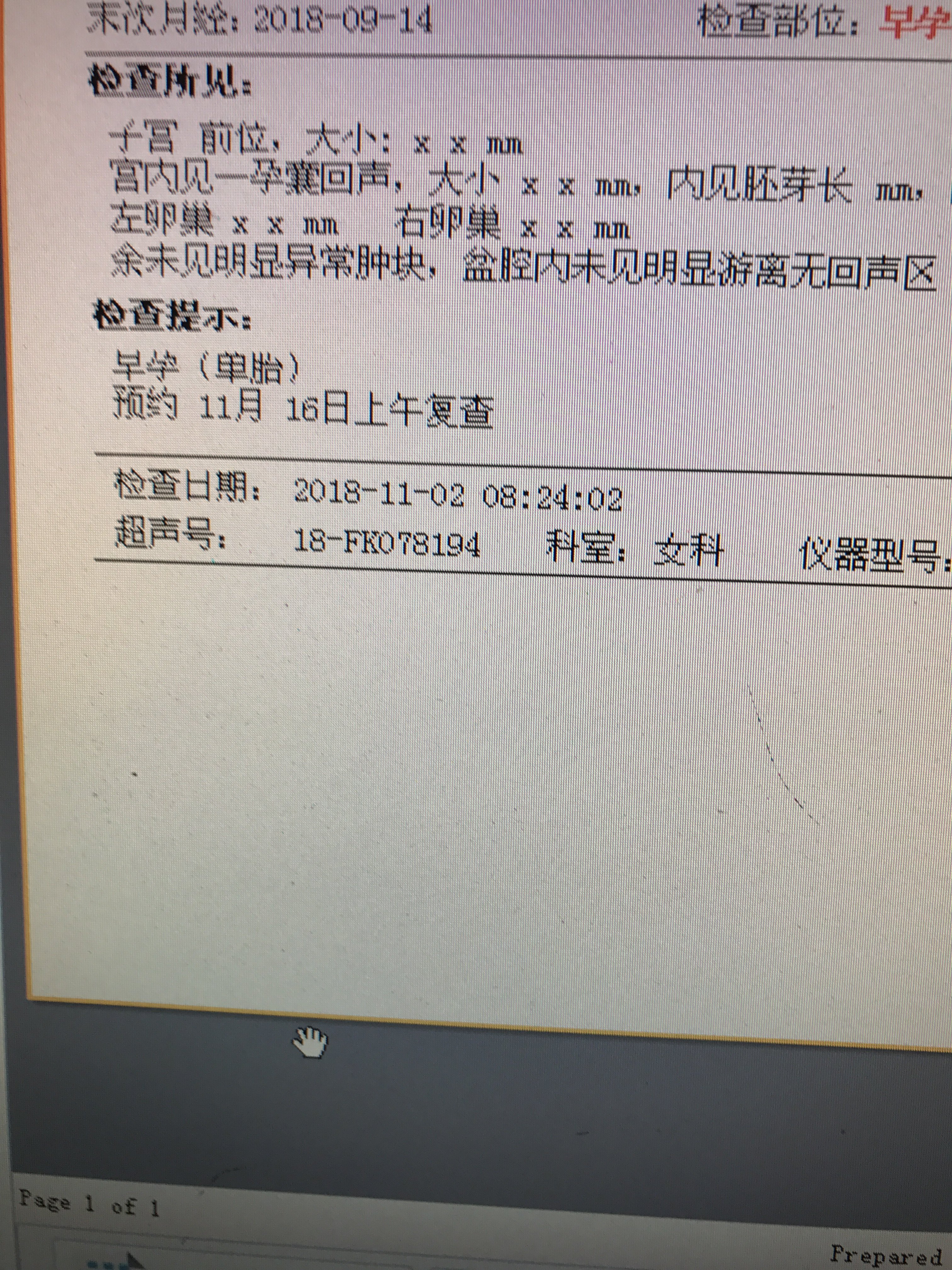 樓醫生宮腔鏡手術後案例四