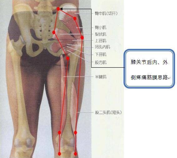 膝关节后内、外侧疼痛思路.jpg