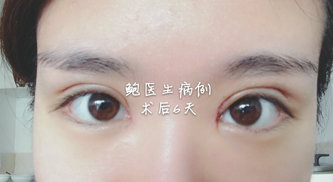 暂无