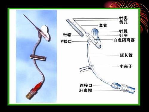 y型留置针封管图解图片