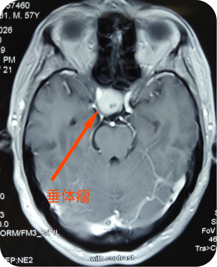 暂无