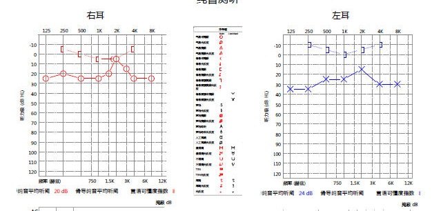 周家朗听力图1.jpg