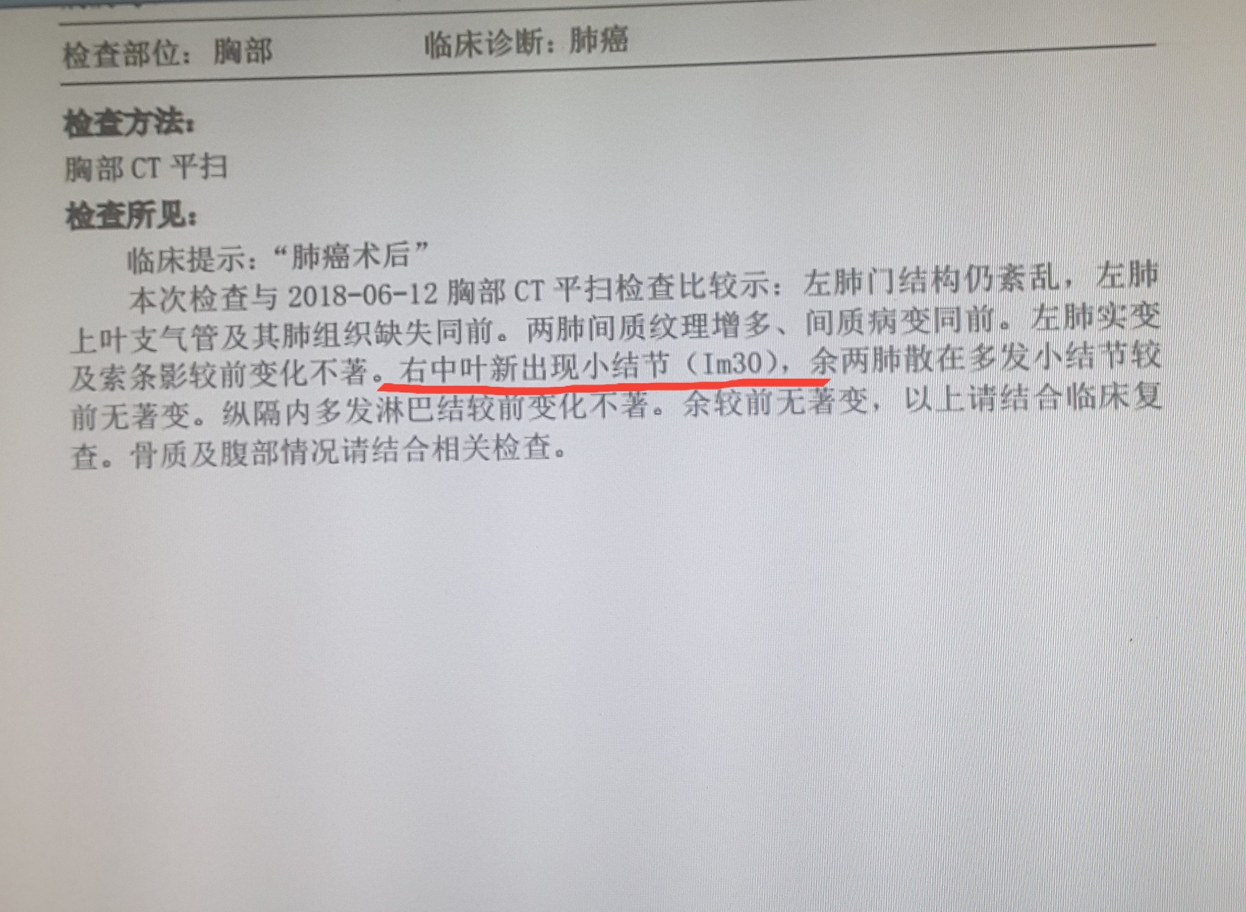 左侧疼是怎么回事男性_左侧疼是哪_男性左侧疼痛位置图