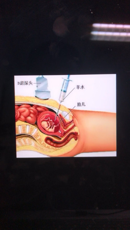視頻封面
