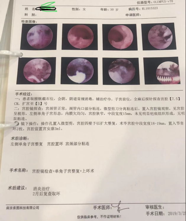 所以宮腔鏡手術在宮腔的整形,比如單角子宮,縱隔