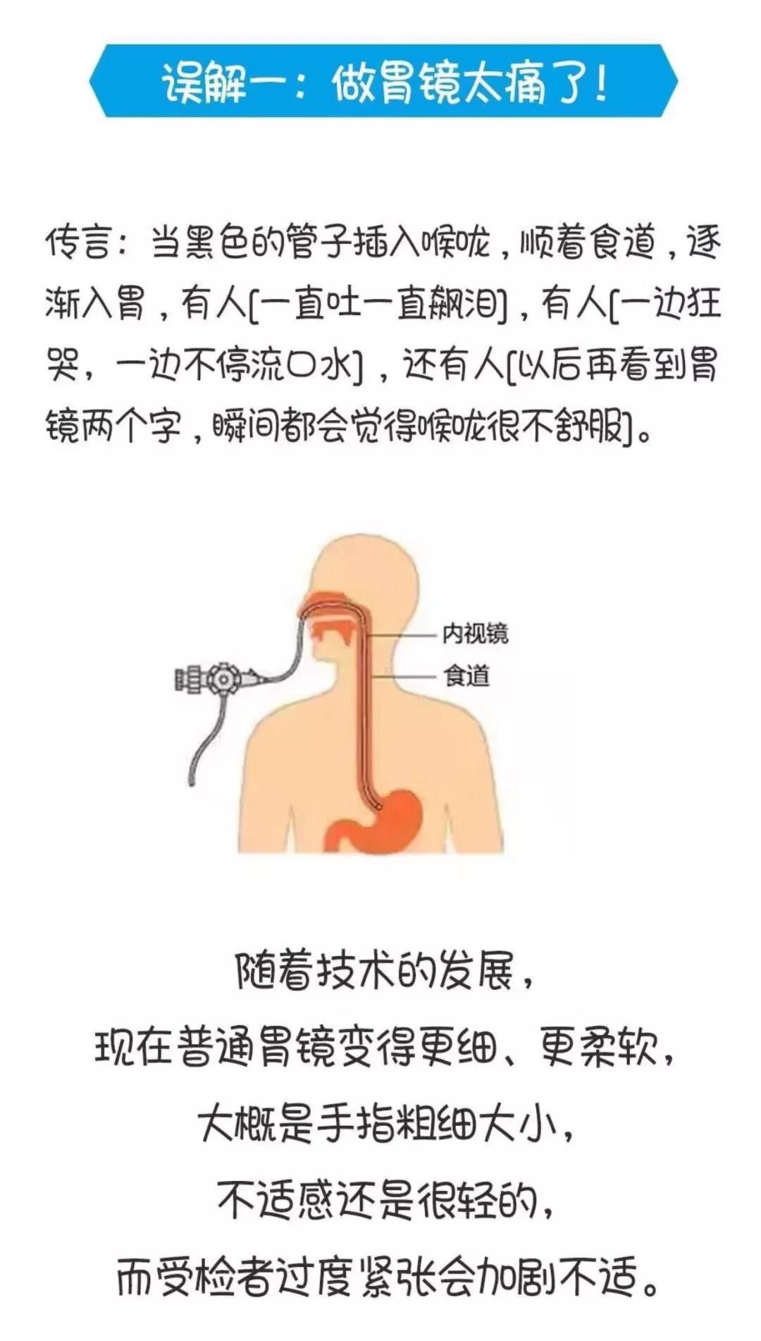 胃镜检查图解 