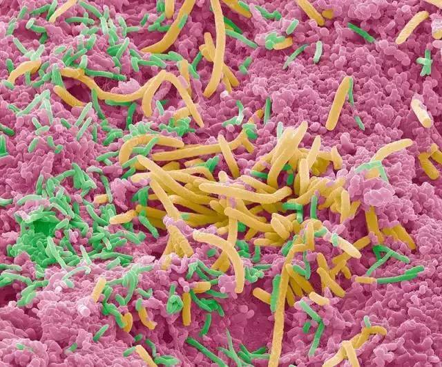细菌恐怖吓人图片