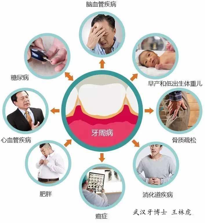 牙齿美白_疾病介绍_治疗介绍 - 好大夫在线