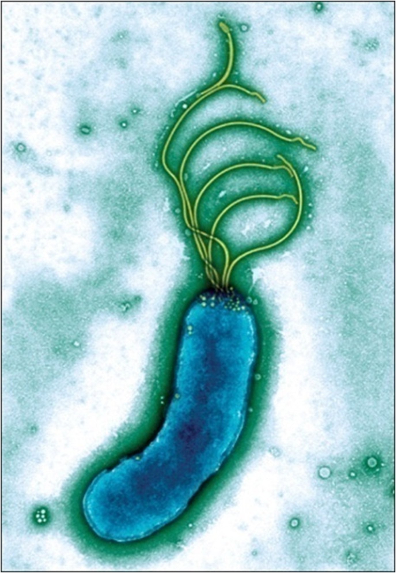 幽门螺杆菌红蓝铅笔图图片