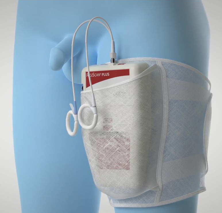 最先进,高效的「勃起功能障碍」诊断工具——夜间阴茎胀大硬度测定(n