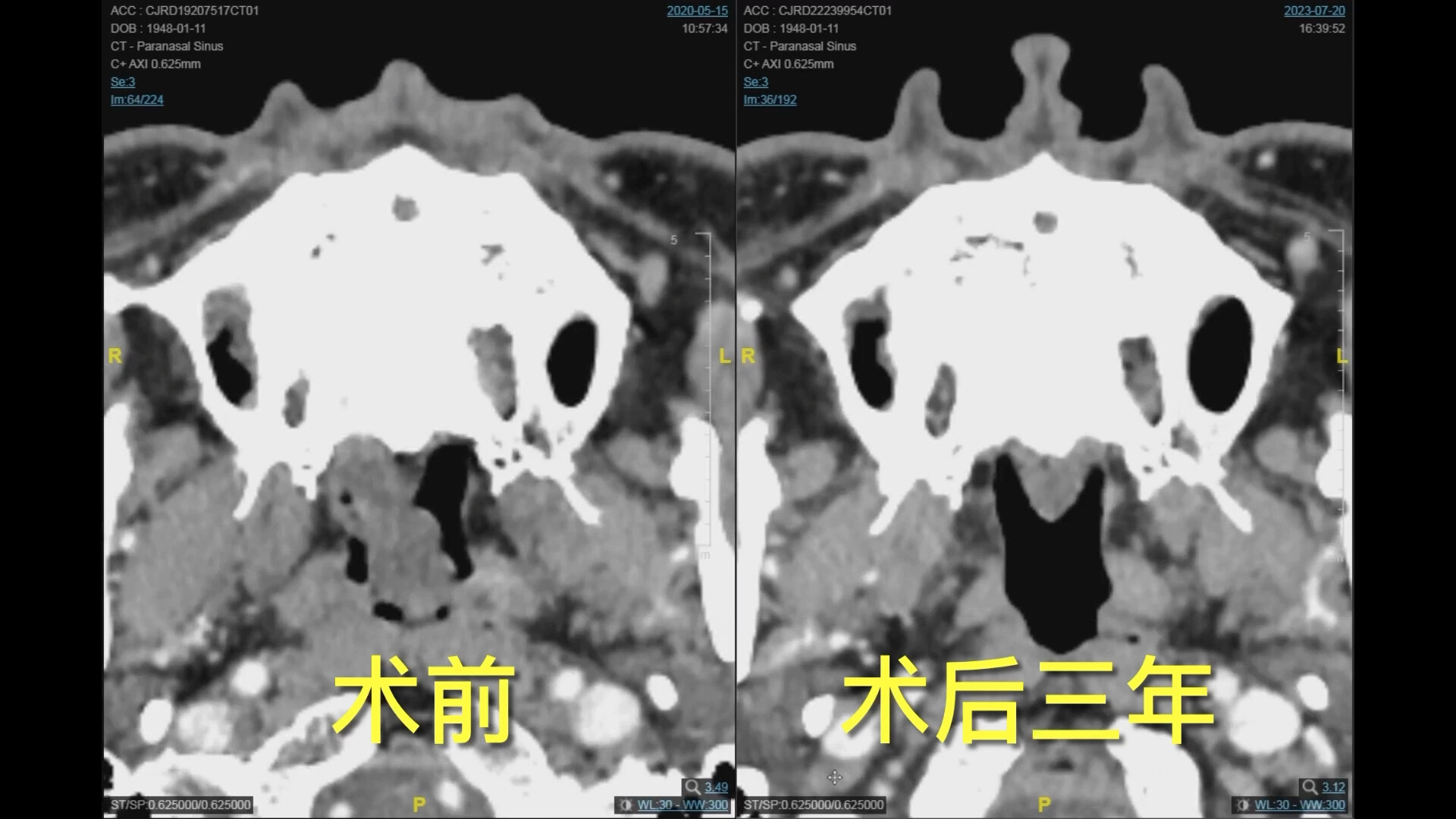 默认图片