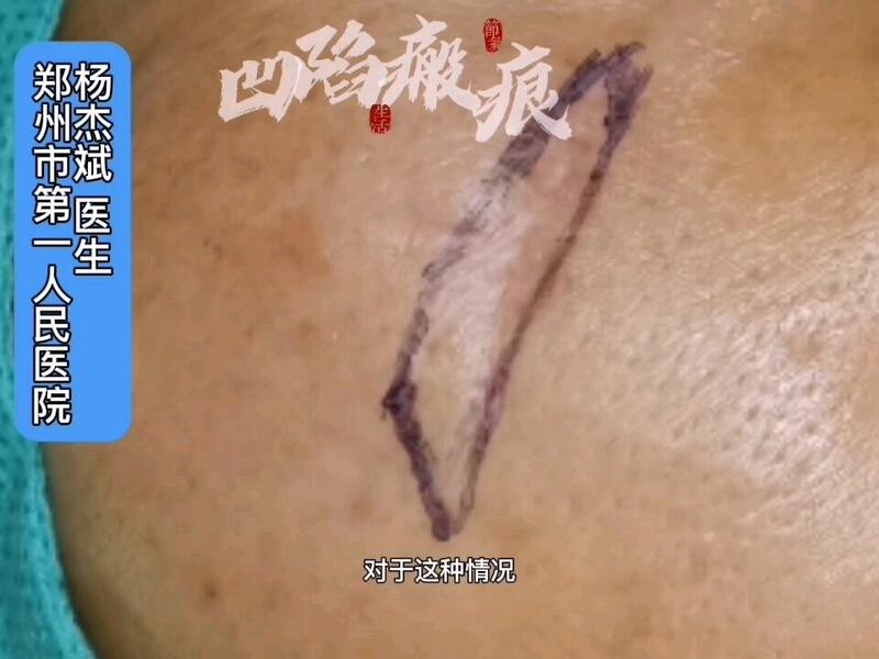 視頻封面