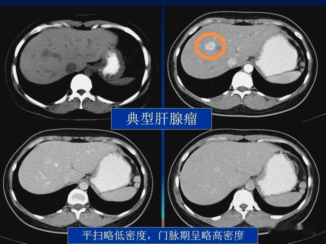 圖文圖片