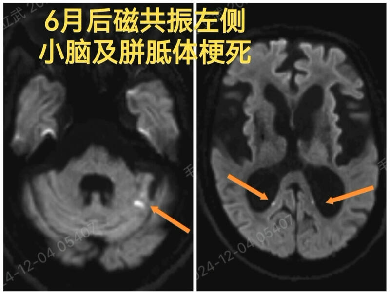 視頻封面