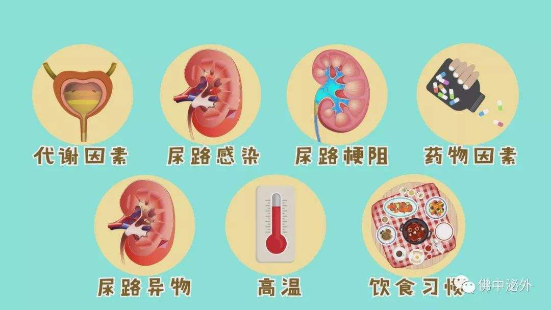 泌尿繫結石的健康宣教