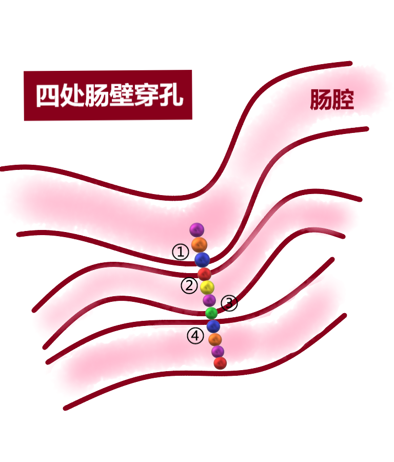 磁力珠对身体有影响吗 磁力珠对身材
有影响吗（磁力珠对身材有影响吗视频） 磁力珠