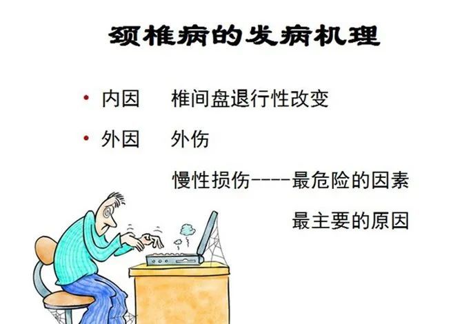带您了解颈椎病的防与治_颈椎病_症状表现_如何预防_治疗方式 - 好