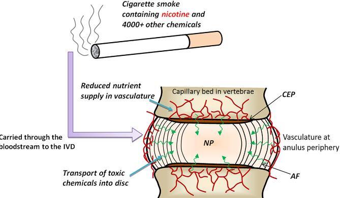 smoking.jpg