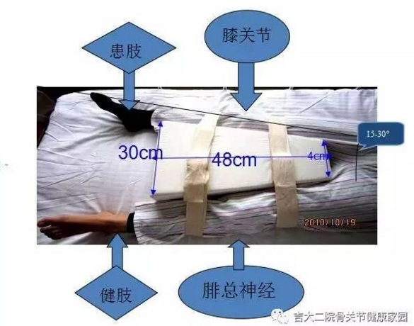 辅助器(梯形垫)术后患肢需保持外展中立位