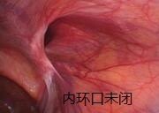暂无