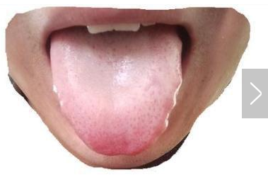 以上症状,如果你占了1——2种,要引起注意了,这说明体内有湿气.