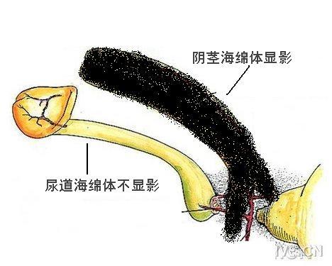静脉漏性阳痿的诊断:解读阴茎海绵体造影