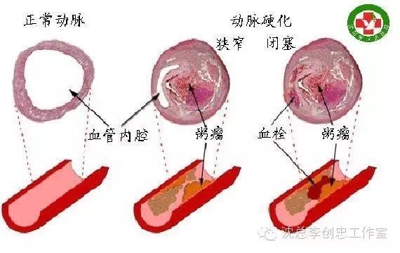 暂无