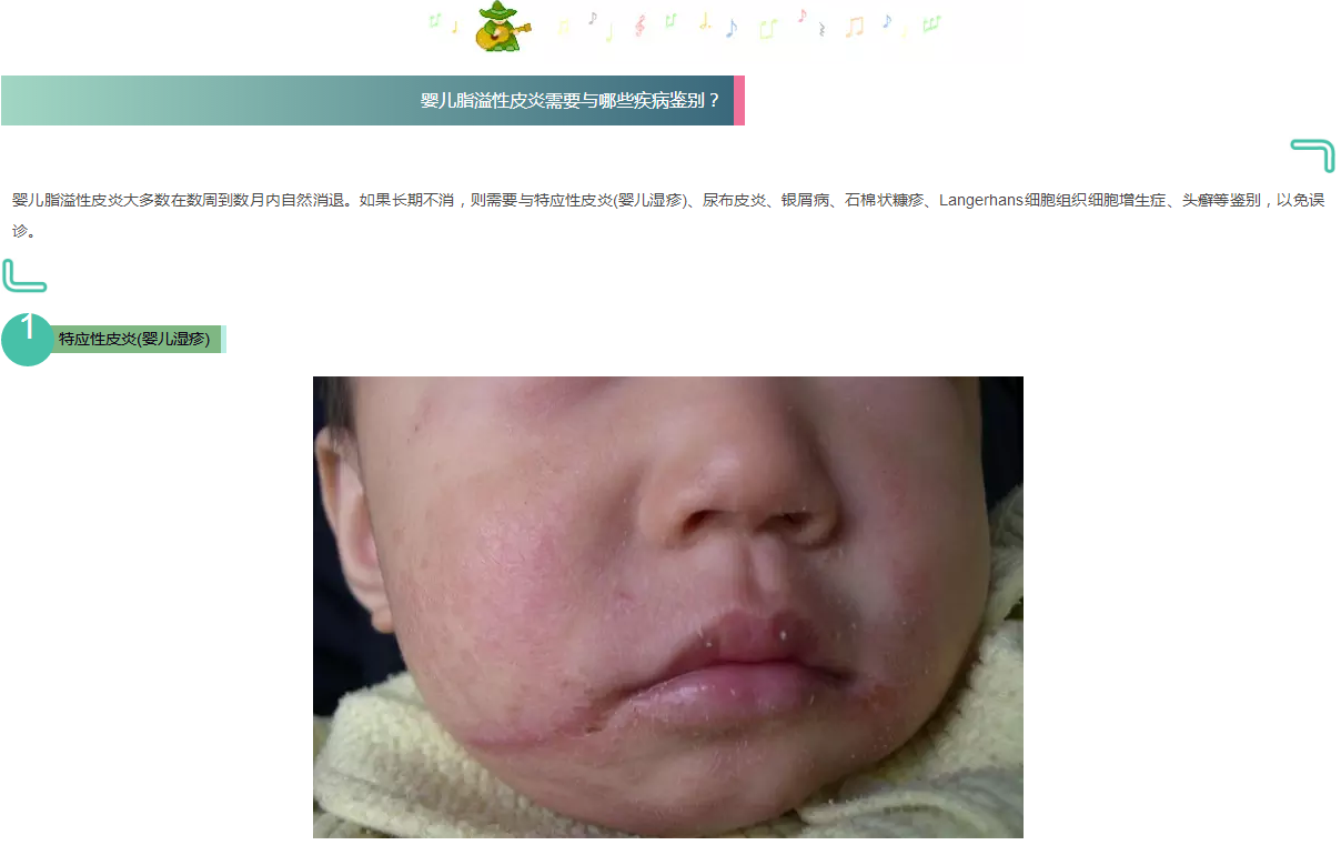 特应性皮炎(婴儿湿疹):在婴儿比较常见,往往有严重的瘙痒,影响喂养和