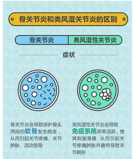 骨关节炎 vs 类风湿性关节炎 - 好大夫在线