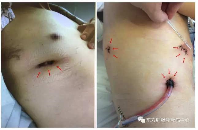 第三期【科普天地】小结节,大学问
