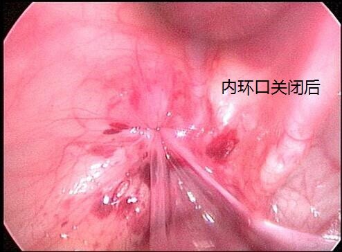 暂无