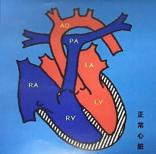 氧合後通過肺靜脈回到了左心房;左心房通過二尖瓣再到左心室,左心室再