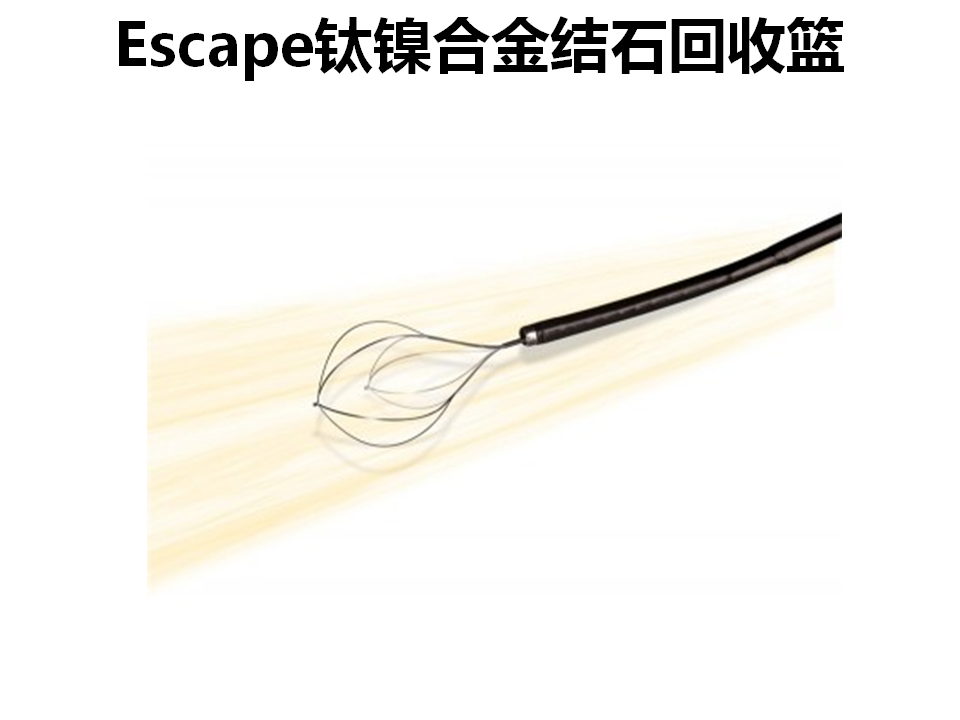 输尿管中上段结石需要使用封堵器防止结石回退肾脏(精华) - 好大夫