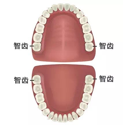 拔智齿能瘦脸吗 该不该拔 关于智齿的7个真相