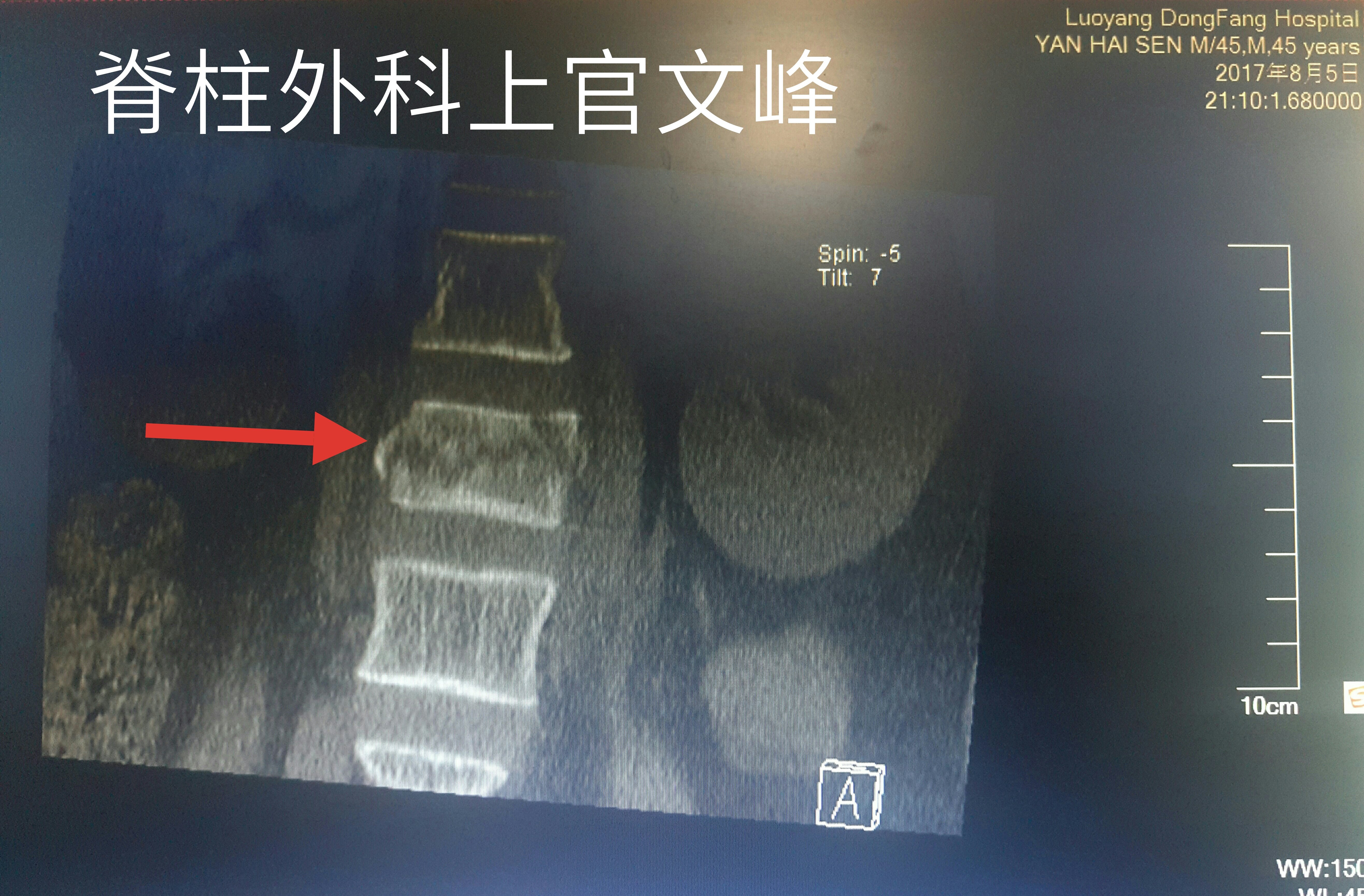 暂无