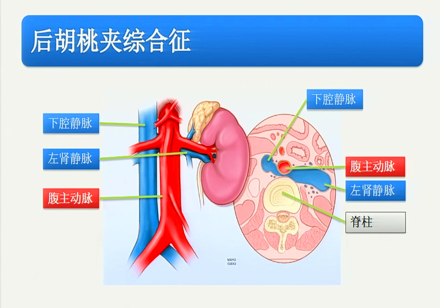 胡桃夹综合征女性图片