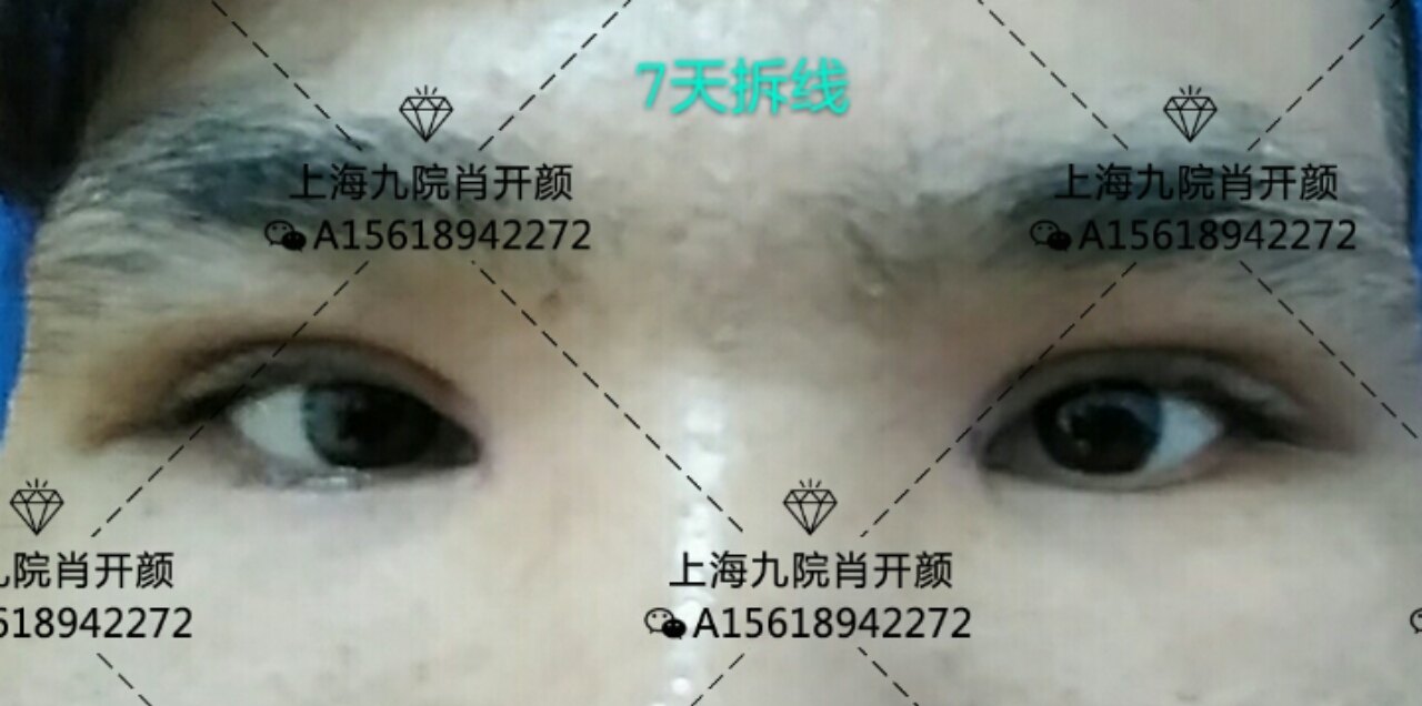 暂无