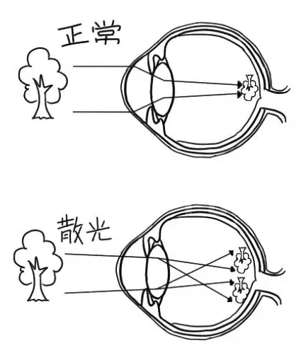 远视眼中的世界图片图片