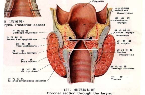 声嘶与喉癌 喉癌的早期表现 喉癌 喉癌症状