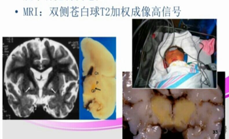 暂无