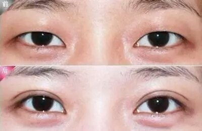 暂无