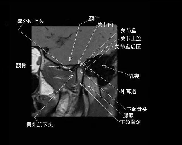 一文看懂:颞下颌关节(转载)