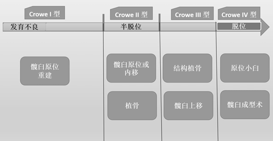 crowe分型对应tha术中的髋臼重建策略