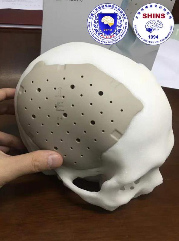 补!——颅骨修补病例及相关科普