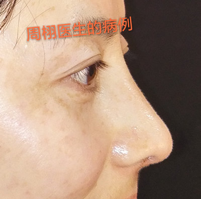 暂无