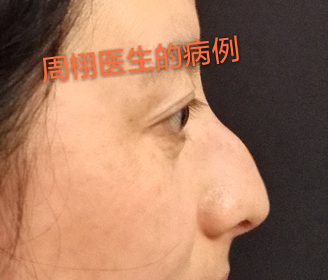 暂无