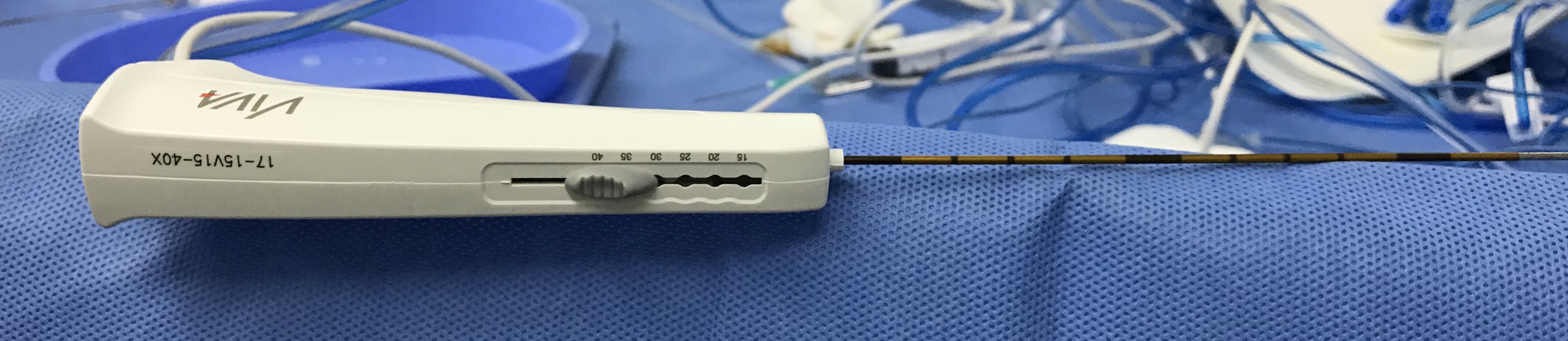 射频消融治疗肝癌术后复发疑难案例分享